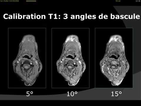 Imagerie multiparamétrique en ORL  quoi de neuf  Dr Jan Casselman