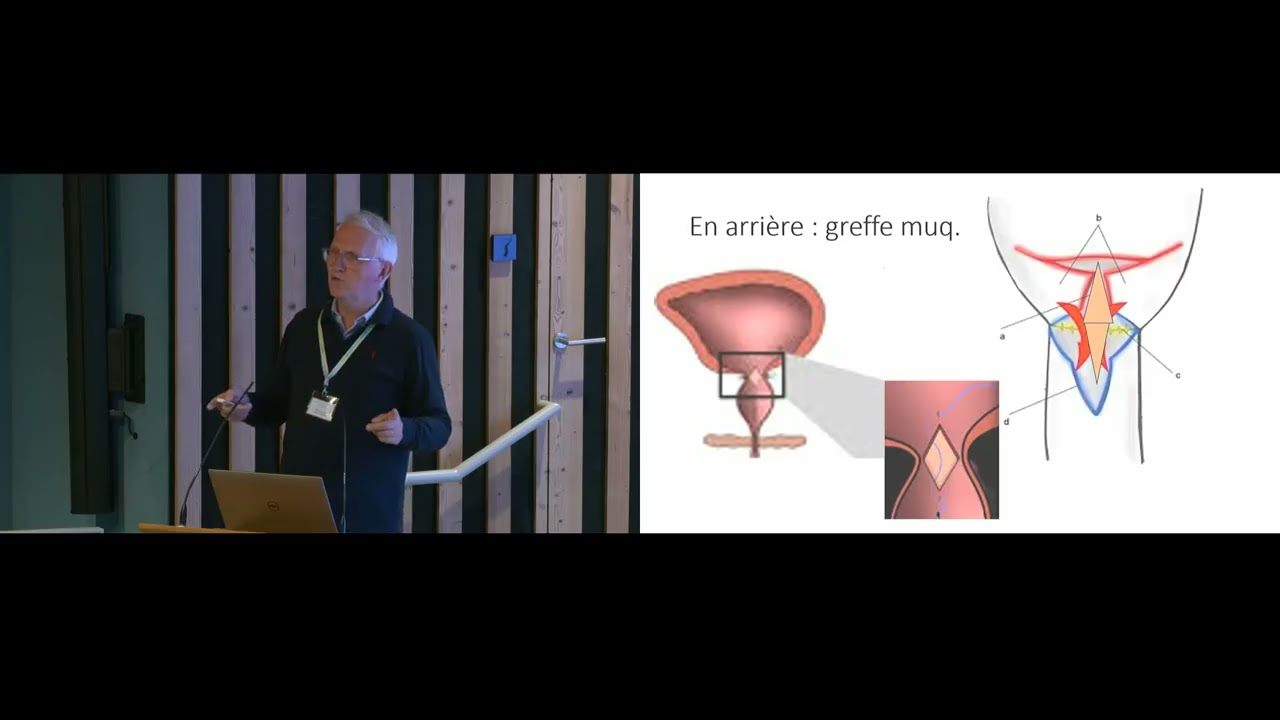 Vendredi - 2 - Et la place en 2024 de ces techniques